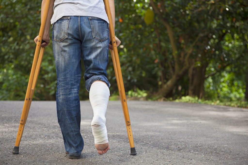 The Ultimate Guide To Car Crash Leg Injuries The Advocates